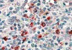 Anti-CD14 antibody, Internal used in IHC (Paraffin sections) (IHC-P). GTX89394