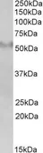 Anti-FSD1 antibody, Internal used in Western Blot (WB). GTX89413