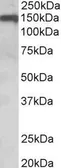 Anti-OMG antibody, Internal used in Western Blot (WB). GTX89414