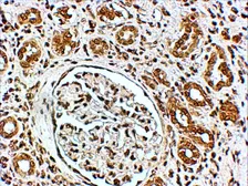 Anti-VPS41 antibody, Internal used in IHC (Paraffin sections) (IHC-P). GTX89439