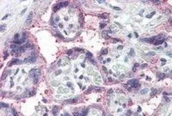 Anti-NOTCH3 antibody, C-term used in IHC (Paraffin sections) (IHC-P). GTX89476