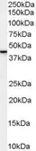 Anti-SPFH2 antibody, C-term used in Western Blot (WB). GTX89522