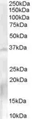 Anti-NANOS1 antibody, C-term used in Western Blot (WB). GTX89524