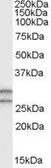 Anti-COMT antibody, N-term used in Western Blot (WB). GTX89530