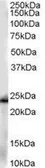 Anti-GSTP1 antibody, Internal used in Western Blot (WB). GTX89536