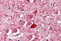 Anti-Parvalbumin antibody, C-term used in IHC (Paraffin sections) (IHC-P). GTX89558