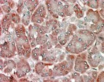 Anti-RBP1 antibody, C-term used in IHC (Paraffin sections) (IHC-P). GTX89561