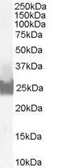 Anti-Bid antibody, C-term used in Western Blot (WB). GTX89562