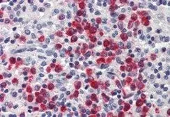 Anti-Lipocalin-2 antibody, Internal used in IHC (Paraffin sections) (IHC-P). GTX89572