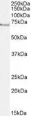 Anti-AChE antibody, C-term used in Western Blot (WB). GTX89580