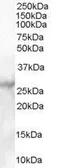 Anti-MBL2 antibody, C-term used in Western Blot (WB). GTX89586