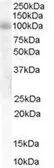 Anti-HPS6 antibody, Internal used in Western Blot (WB). GTX89591