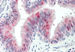 Anti-ZDHHC13 antibody, C-term used in IHC (Paraffin sections) (IHC-P). GTX89603