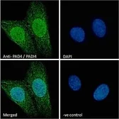 Anti-PAD4 antibody, N-term used in Immunocytochemistry/ Immunofluorescence (ICC/IF). GTX89631