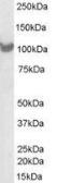 Anti-PSMD2 antibody, C-term used in Western Blot (WB). GTX89633