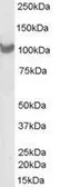 Anti-PSMD2 antibody, C-term used in Western Blot (WB). GTX89633