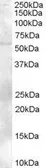 Anti-TZFP antibody, C-term used in Western Blot (WB). GTX89643