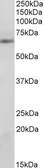 Anti-SOCS5 antibody, N-term used in Western Blot (WB). GTX89655