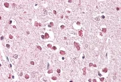 Anti-XAB2 antibody, C-term used in IHC (Paraffin sections) (IHC-P). GTX89674
