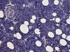 Anti-KLF1 antibody, N-term used in IHC (Paraffin sections) (IHC-P). GTX89710