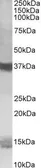 Anti-Prefoldin 1 antibody, C-term used in Western Blot (WB). GTX89717