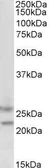Anti-FBXO44 antibody, C-term used in Western Blot (WB). GTX89727