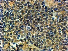 Anti-Blimp1 antibody, C-term used in IHC (Paraffin sections) (IHC-P). GTX89762