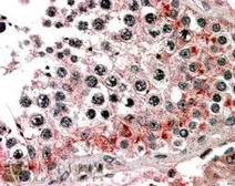 Anti-ABCB9 antibody, C-term used in IHC (Paraffin sections) (IHC-P). GTX89769