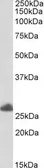 Anti-RNF35 antibody, C-term used in Western Blot (WB). GTX89816