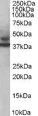 Anti-MURF3 antibody, C-term used in Western Blot (WB). GTX89822