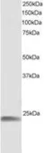 Anti-HSP22 antibody, C-term used in Western Blot (WB). GTX89843