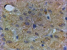 Anti-PEX13 antibody, C-term used in IHC (Paraffin sections) (IHC-P). GTX89859