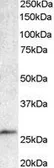 Anti-BCL7A antibody, C-term used in Western Blot (WB). GTX89978