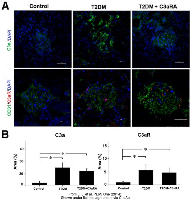 C3a Receptor抗体 (GTX114293)