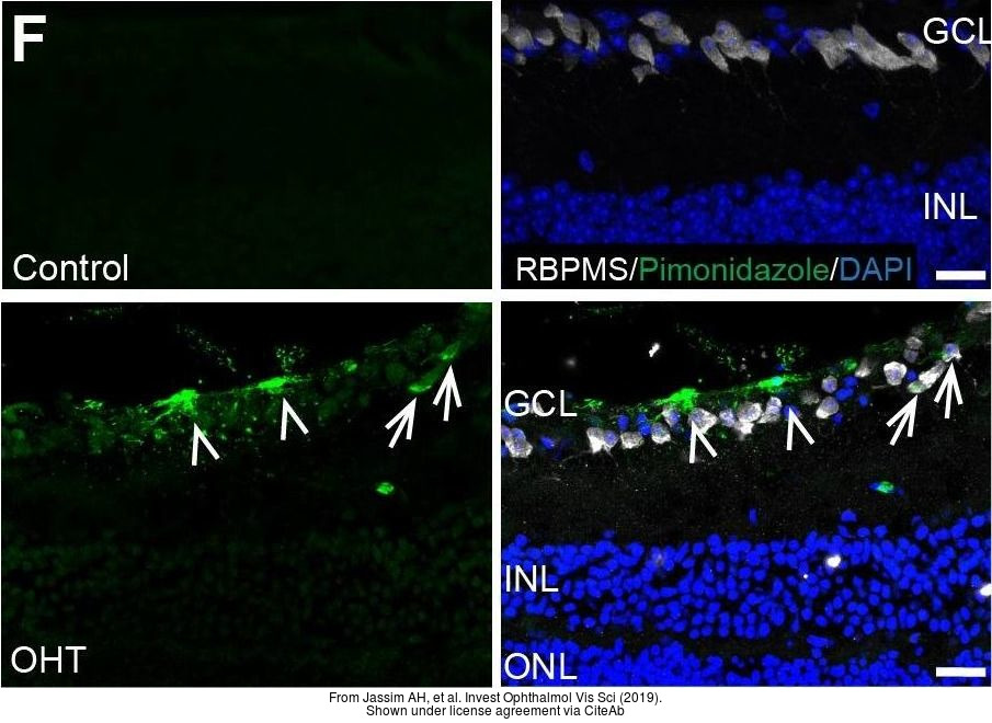 RBPMS抗体 (GTX118619) | GeneTex中国官方网站
